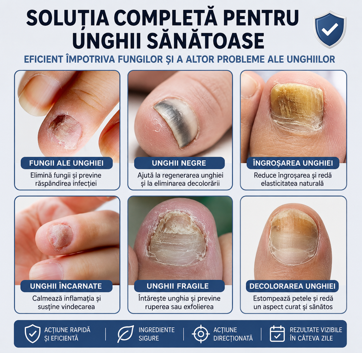 NailCare Pro – Tratament Antifungic pentru Unghii